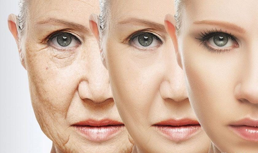 افقی زنا ضد پیری e1760015337400 خرید و قیمت کرم ضد چروک ویچی Vichy Anti-Wrinkle Cream تولید امارات برای سفتکننده و جوانسازی پوست