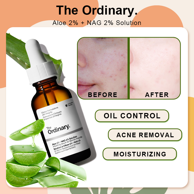 سرم آلوئه + NAG اوردینری (The Ordinary Aloe + NAG Serum) مناسب برای تسکین، آبرسانی و شادابی پوست