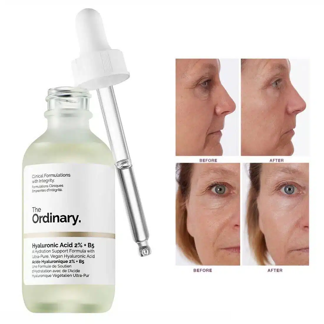 جای سرم هیالورونیک اسید اوردینری The Ordinary Hyaluronic Acid 2% + B5 مناسب برای آبرسانی عمیق، حفظ رطوبت و افزایش نرمی و لطافت پوست